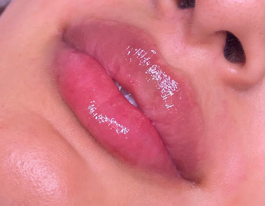 0.5ML LIP FILLER