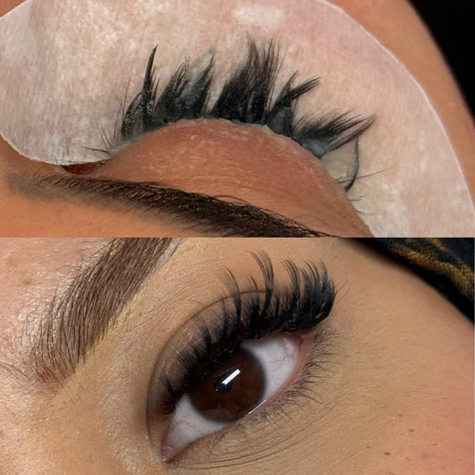 REMOVAL AND FRESH SET